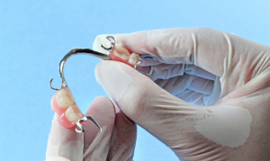 Dentures also require maintenance and repair.