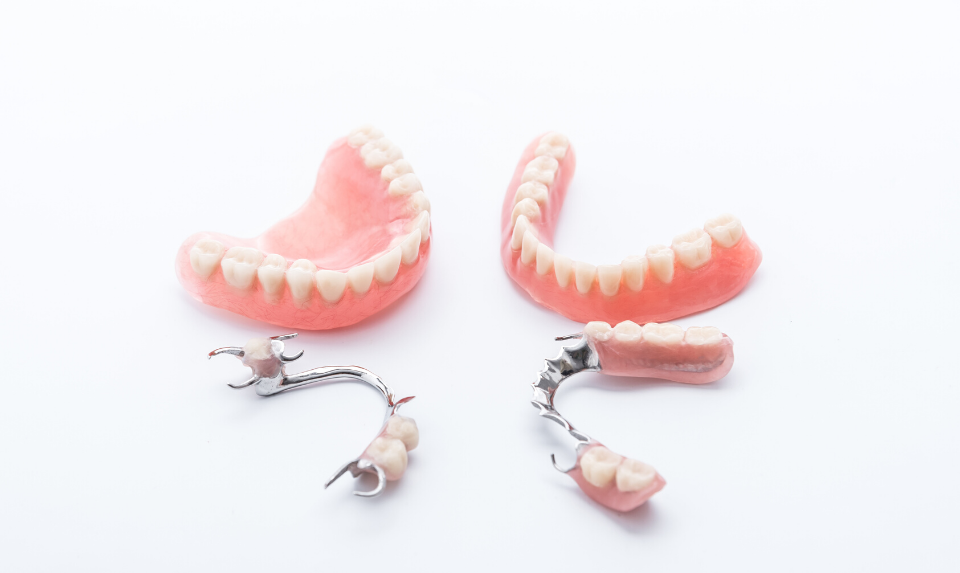 Denture repair should be done by a professional to ensure the correct fit.
