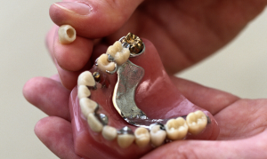 Dentures also require maintenance and repair.